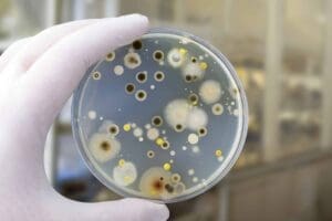 Mold in a petri dish